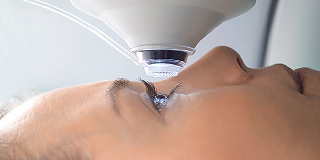 Augen lasern lassen Augen Operation
